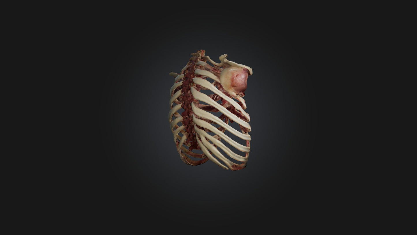 3D model Infected Rib Cage VR / AR / low-poly