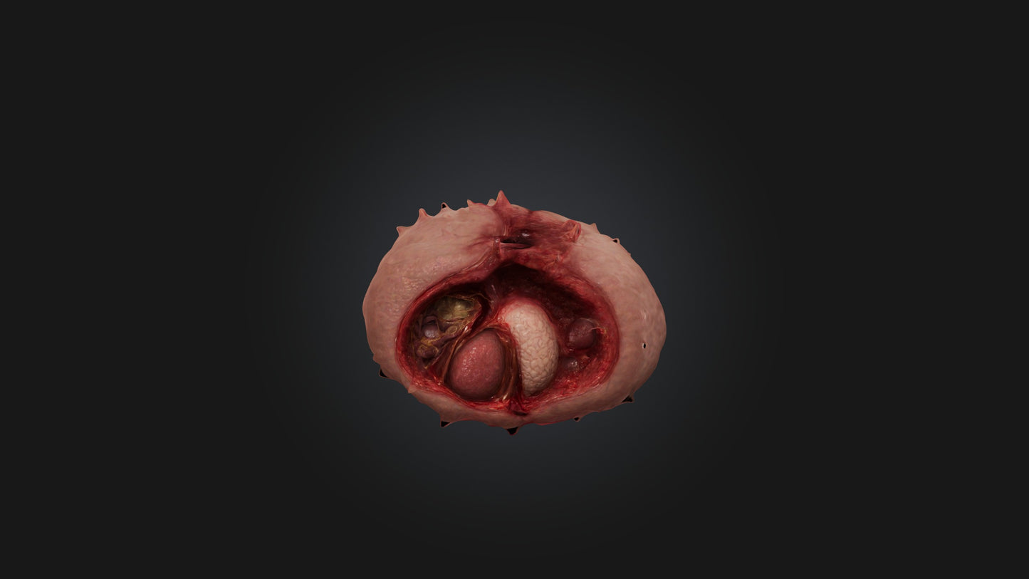 3D model Infected Spleen VR / AR / low-poly