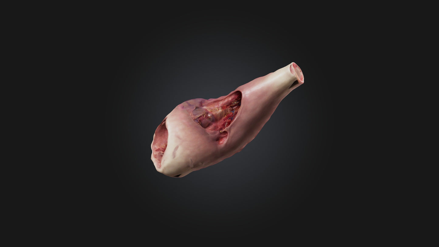 3D model Infected Esophagus VR / AR / low-poly