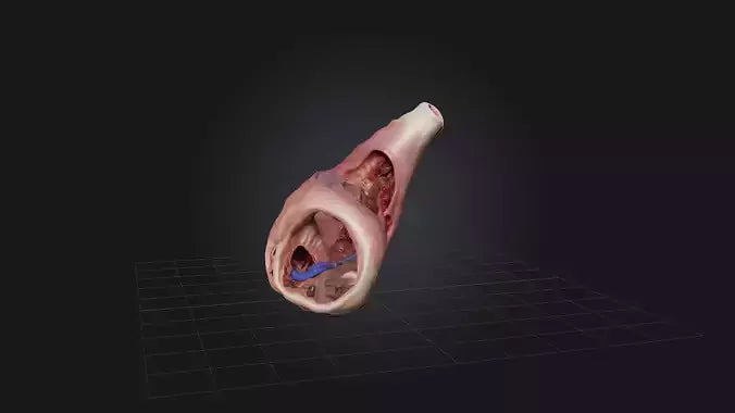 3D model Infected Esophagus VR / AR / low-poly