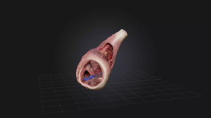 3D model Infected Esophagus VR / AR / low-poly