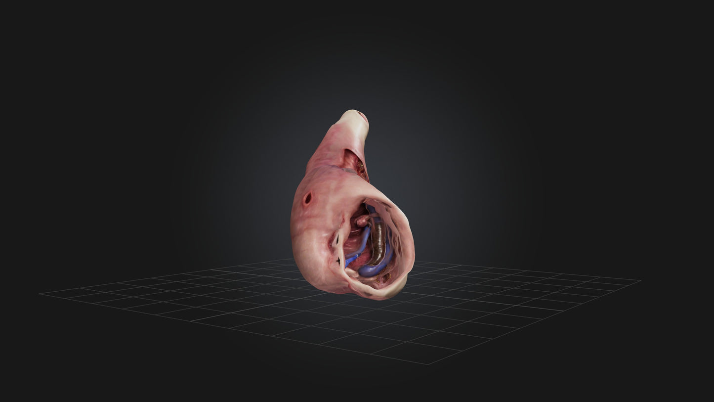 3D model Infected Esophagus VR / AR / low-poly