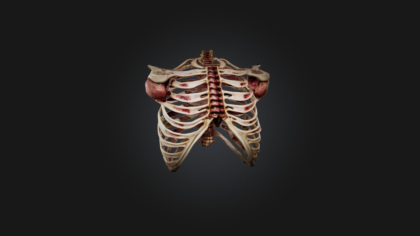 3D model Infected Rib Cage VR / AR / low-poly