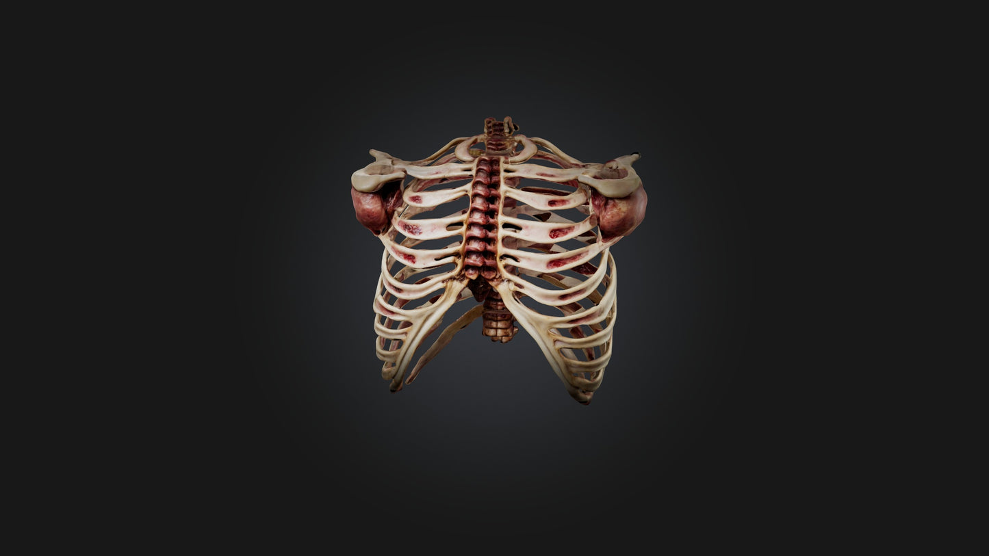 3D model Infected Rib Cage VR / AR / low-poly