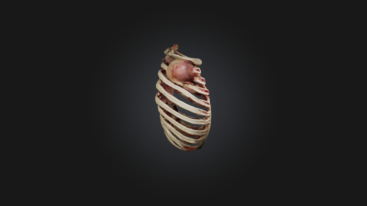 3D model Infected Rib Cage VR / AR / low-poly