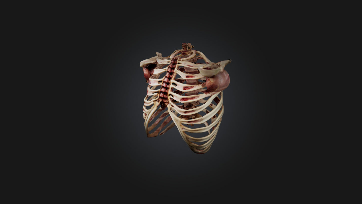 3D model Infected Rib Cage VR / AR / low-poly
