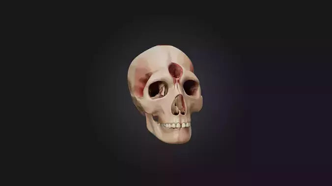 3D model Infected Sinus VR / AR / low-poly