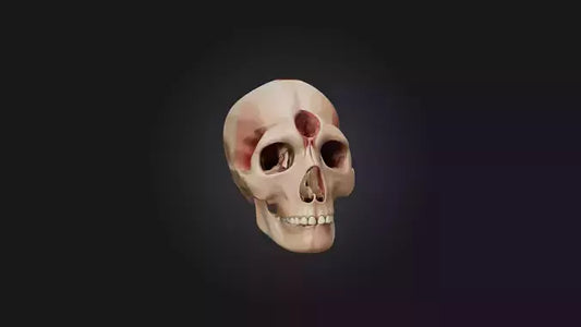 3D model Infected Sinus VR / AR / low-poly