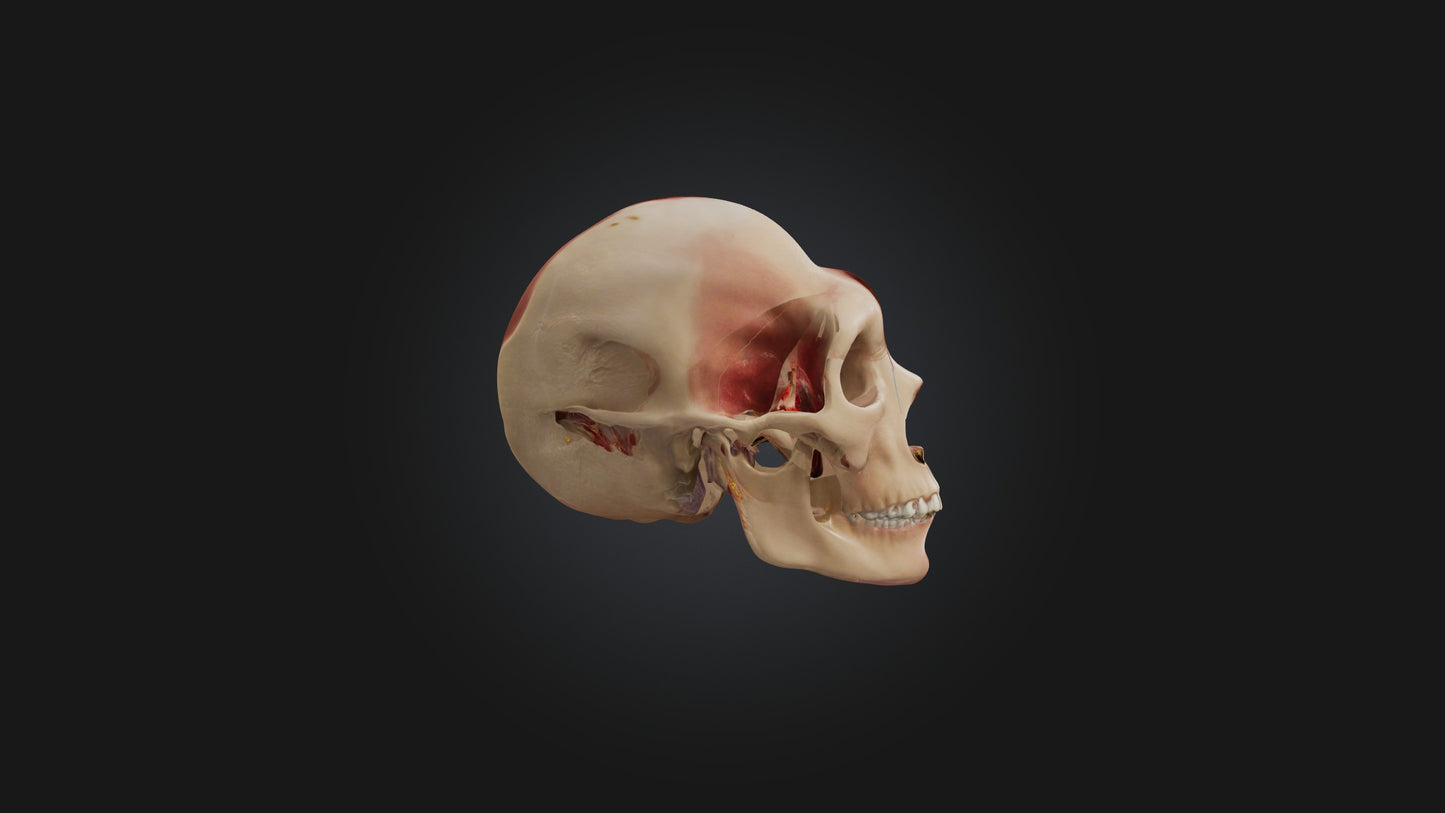 3D model Infected Sinus VR / AR / low-poly
