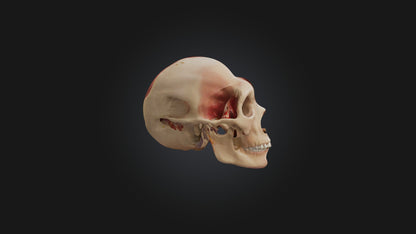 3D model Infected Sinus VR / AR / low-poly