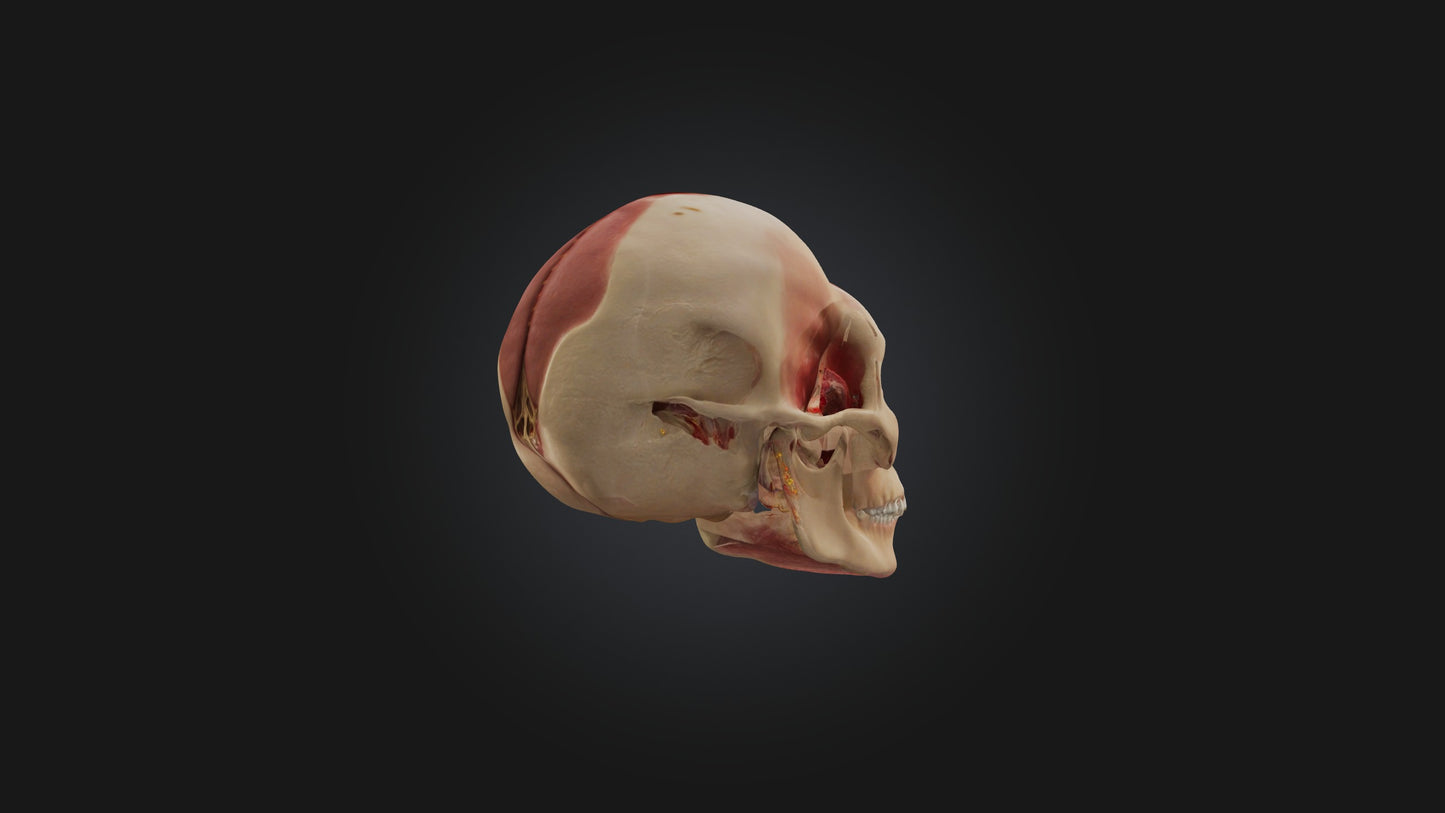 3D model Infected Sinus VR / AR / low-poly