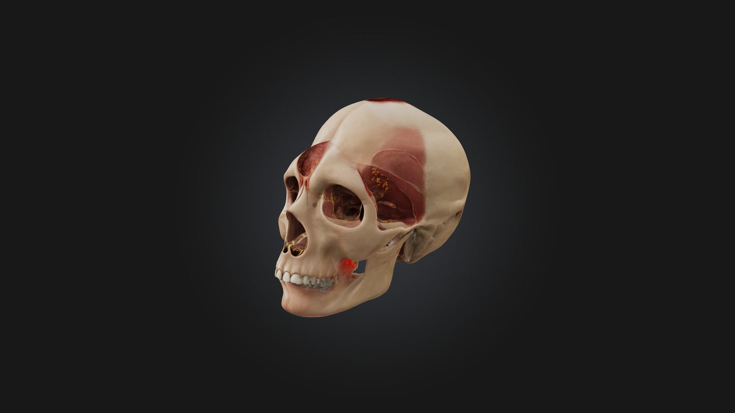 3D model Infected Sinus VR / AR / low-poly