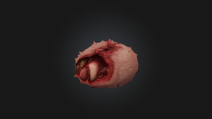 3D model Infected Spleen VR / AR / low-poly
