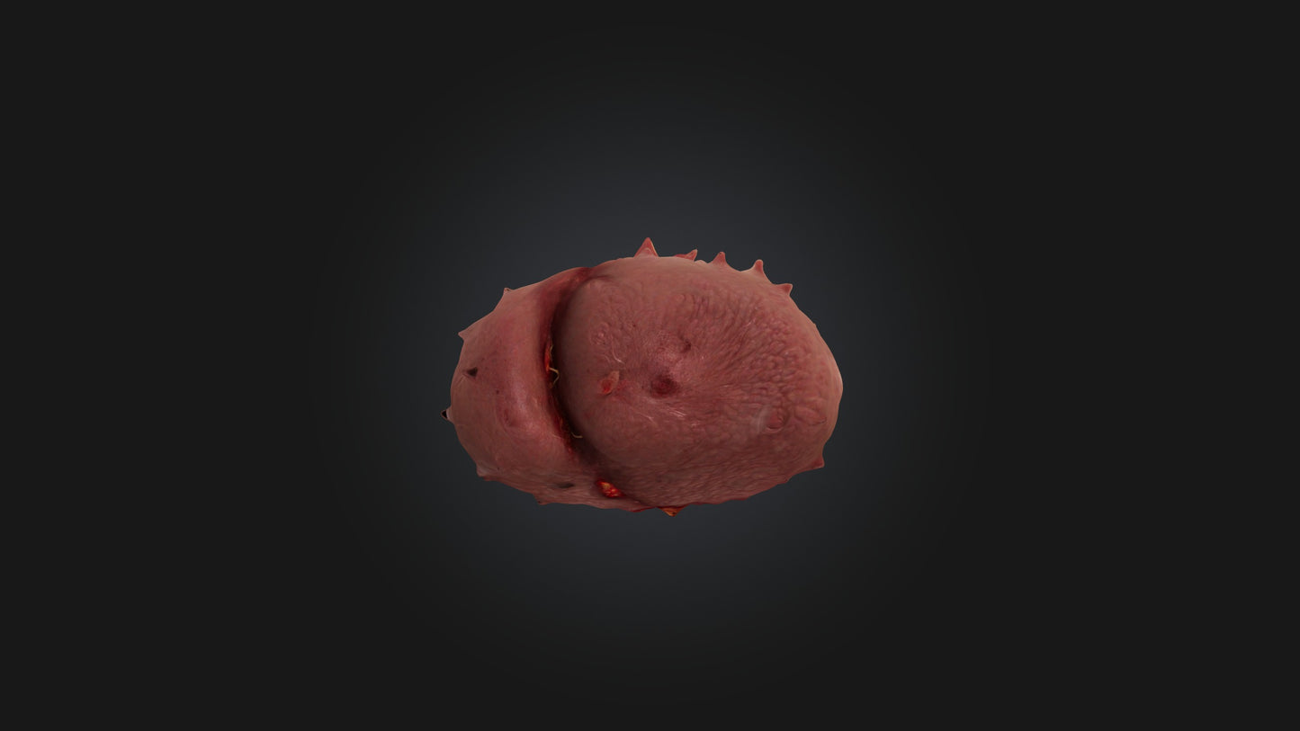 3D model Infected Spleen VR / AR / low-poly