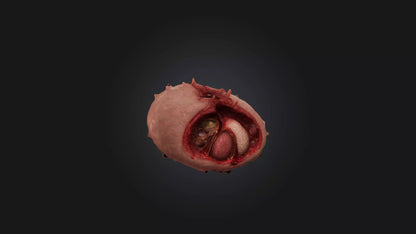 3D model Infected Spleen VR / AR / low-poly