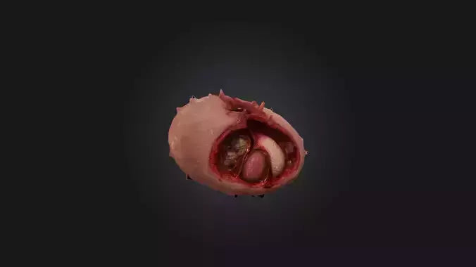 3D model Infected Spleen VR / AR / low-poly