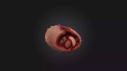 3D model Infected Spleen VR / AR / low-poly